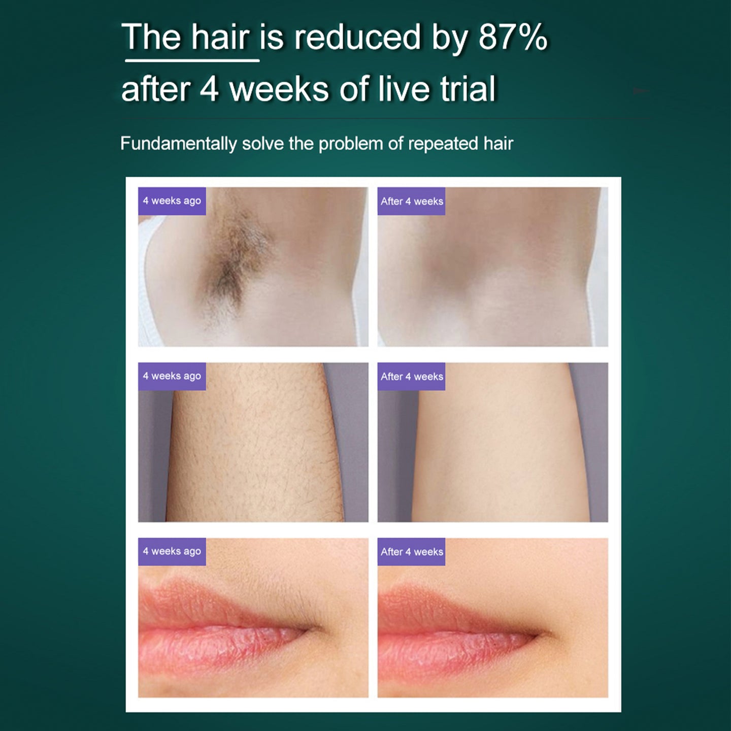 {{ IPL Hair Removal Machine Suitable For Home Use Gentle Long Lasting Hair Removal }} - Buy Car Parts Online at {{ Kaka Auto Parts }}.