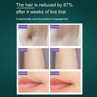 {{ IPL Hair Removal Machine Suitable For Home Use Gentle Long Lasting Hair Removal }} - Buy Car Parts Online at {{ Kaka Auto Parts }}.
